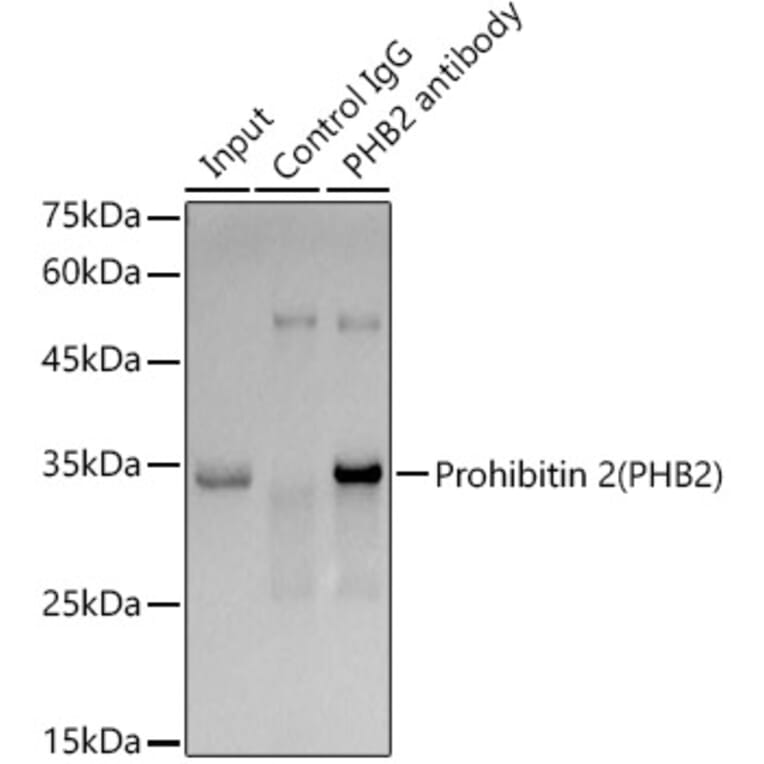 Western Blot - Anti-REA Antibody [ARC1449] (A308350) - Antibodies.com