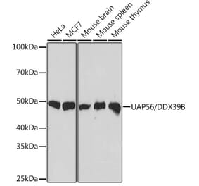 Western Blot - Anti-UAP56 Antibody [ARC1731] (A308352) - Antibodies.com
