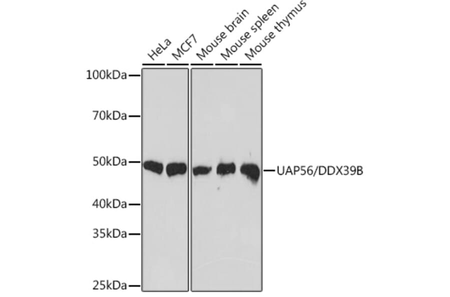 Western Blot - Anti-UAP56 Antibody [ARC1731] (A308352) - Antibodies.com