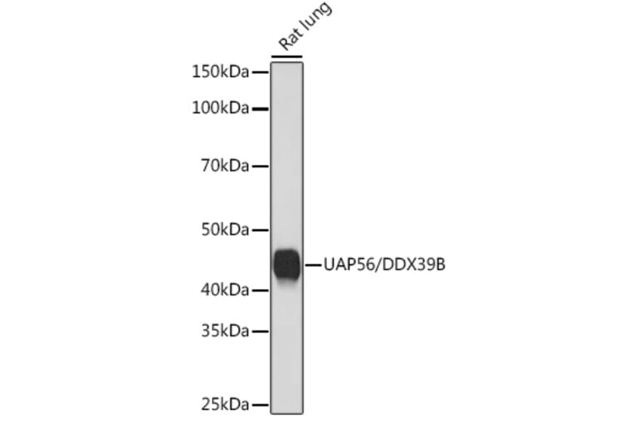 Western Blot - Anti-UAP56 Antibody [ARC1731] (A308352) - Antibodies.com