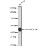Western Blot - Anti-UAP56 Antibody [ARC1731] (A308352) - Antibodies.com