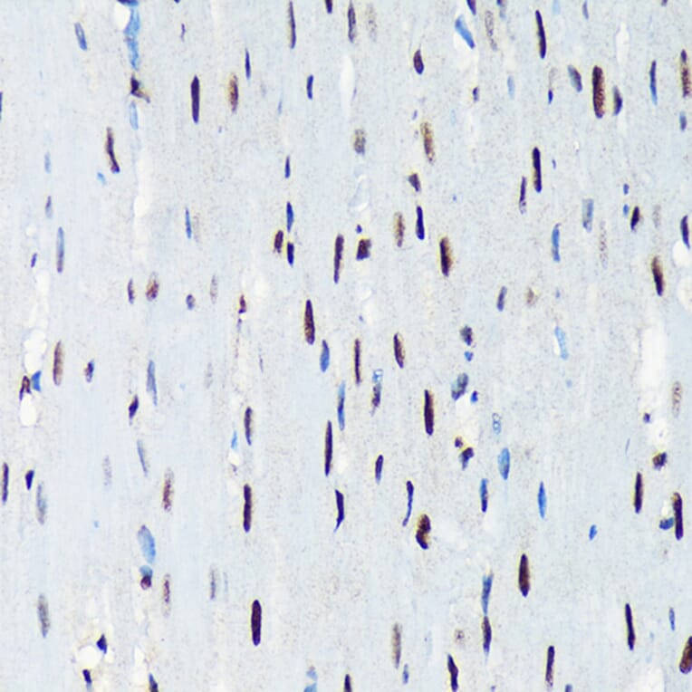 Immunohistochemistry - Anti-UAP56 Antibody [ARC1731] (A308352) - Antibodies.com