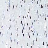 Immunohistochemistry - Anti-UAP56 Antibody [ARC1731] (A308352) - Antibodies.com