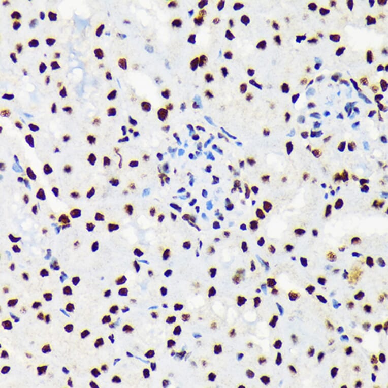 Immunohistochemistry - Anti-UAP56 Antibody [ARC1731] (A308352) - Antibodies.com