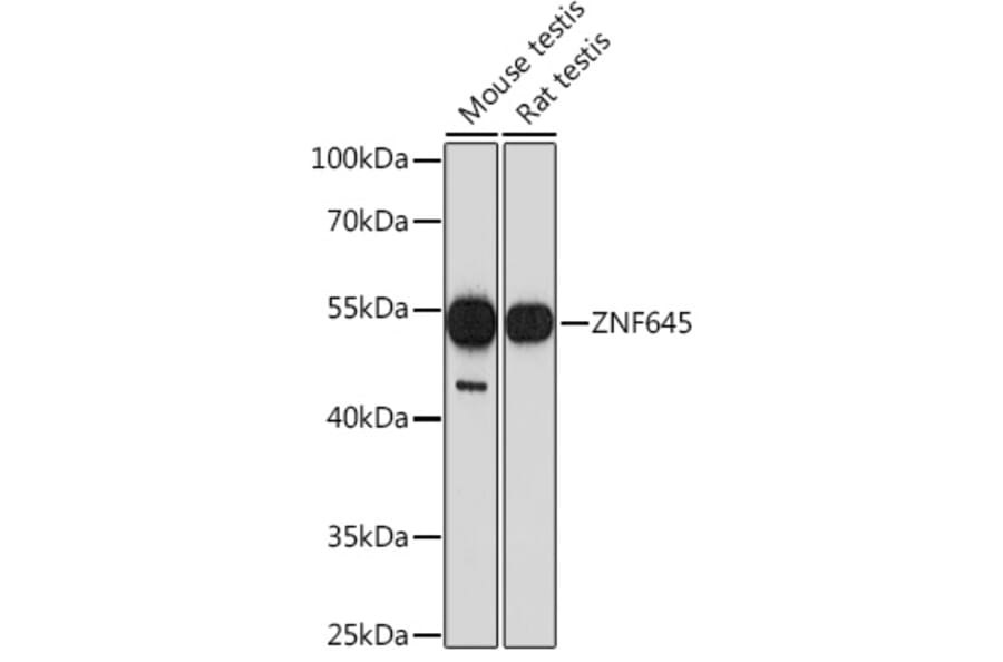 Western Blot - Anti-CBLL2 Antibody (A308353) - Antibodies.com