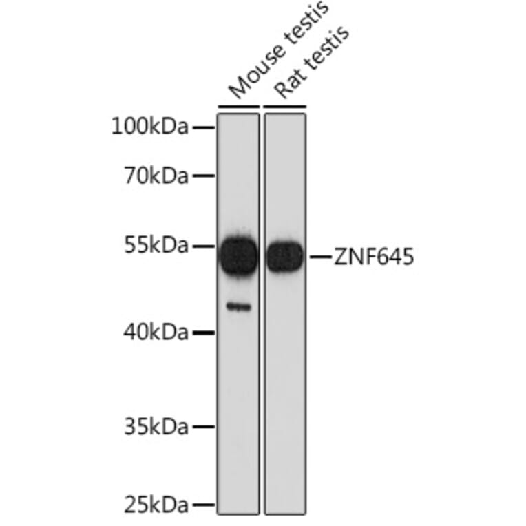 Western Blot - Anti-CBLL2 Antibody (A308353) - Antibodies.com
