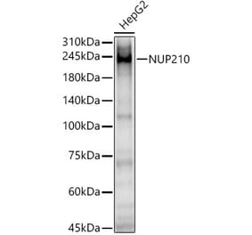 Western Blot - Anti-NUP210 Antibody (A308355) - Antibodies.com