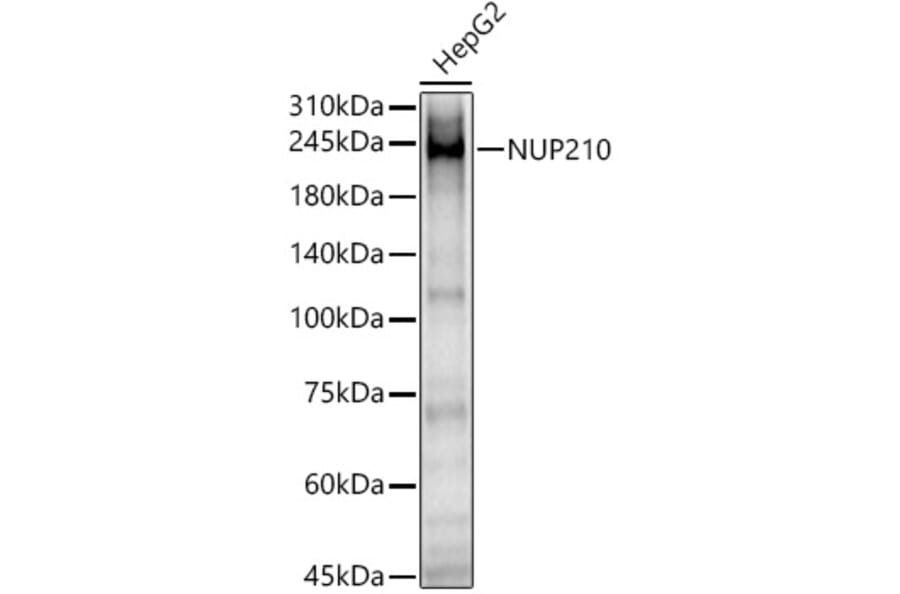 Western Blot - Anti-NUP210 Antibody (A308355) - Antibodies.com