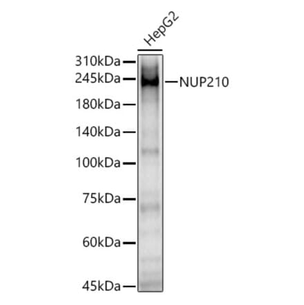 Western Blot - Anti-NUP210 Antibody (A308355) - Antibodies.com