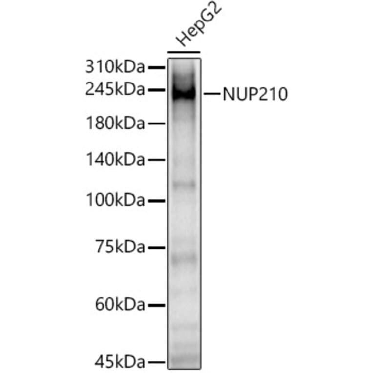 Western Blot - Anti-NUP210 Antibody (A308355) - Antibodies.com