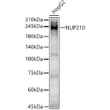 Western Blot - Anti-NUP210 Antibody (A308355) - Antibodies.com