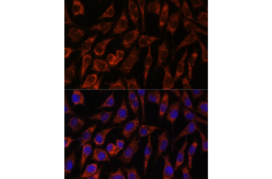 Immunofluorescence - Anti-NUP210 Antibody (A308355) - Antibodies.com