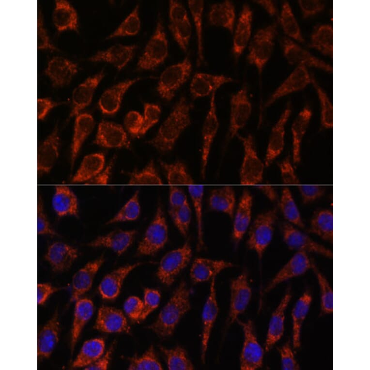 Immunofluorescence - Anti-NUP210 Antibody (A308355) - Antibodies.com