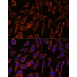 Immunofluorescence - Anti-NUP210 Antibody (A308355) - Antibodies.com