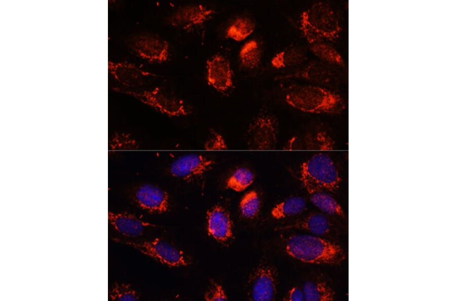 Immunofluorescence - Anti-NUP210 Antibody (A308355) - Antibodies.com