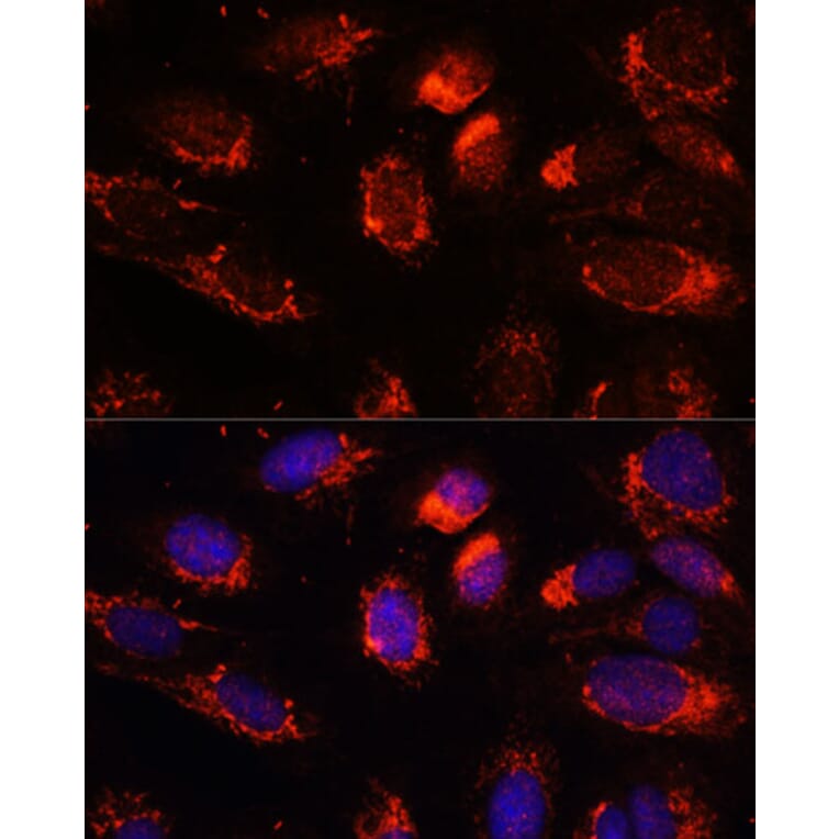 Immunofluorescence - Anti-NUP210 Antibody (A308355) - Antibodies.com