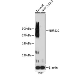 Western Blot - Anti-NUP210 Antibody (A308356) - Antibodies.com