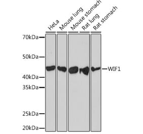 Western Blot - Anti-WIF1 Antibody [ARC1161] (A308357) - Antibodies.com