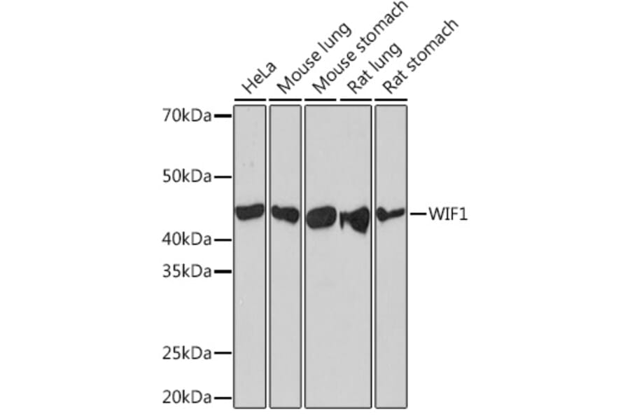 Western Blot - Anti-WIF1 Antibody [ARC1161] (A308357) - Antibodies.com