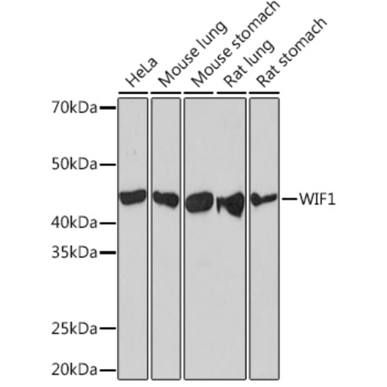 Western Blot - Anti-WIF1 Antibody [ARC1161] (A308357) - Antibodies.com