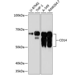 Western Blot - Anti-CD14 Antibody [ARC0353] (A308358) - Antibodies.com