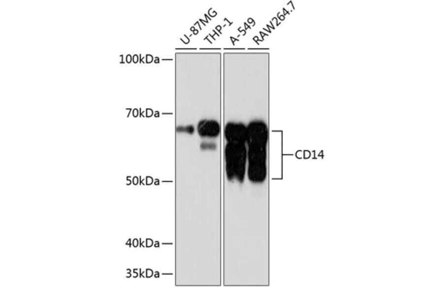 Western Blot - Anti-CD14 Antibody [ARC0353] (A308358) - Antibodies.com