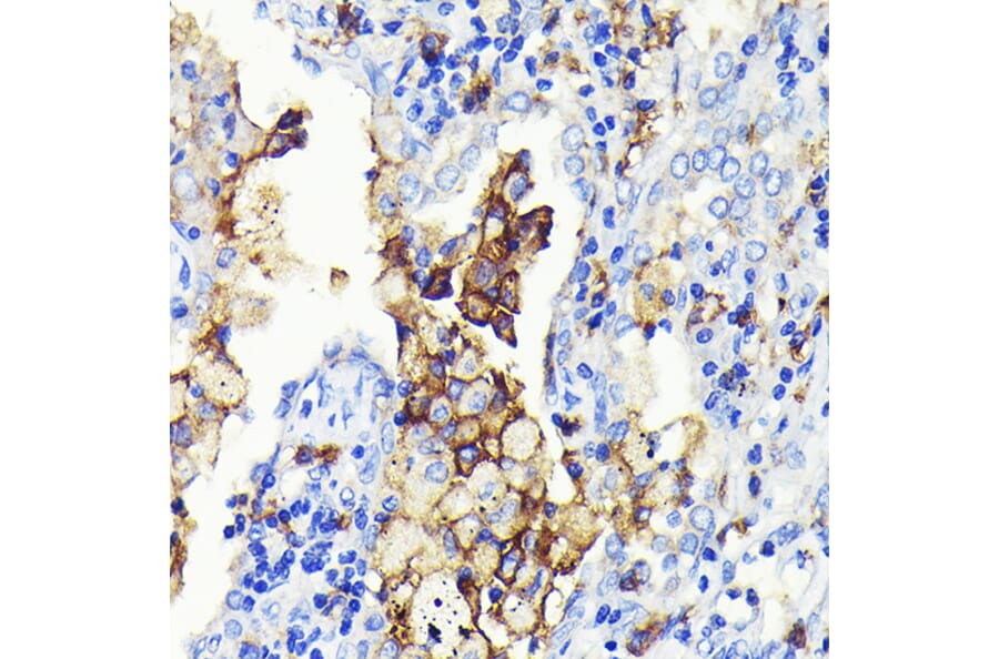 Immunohistochemistry - Anti-CD14 Antibody [ARC0353] (A308358) - Antibodies.com