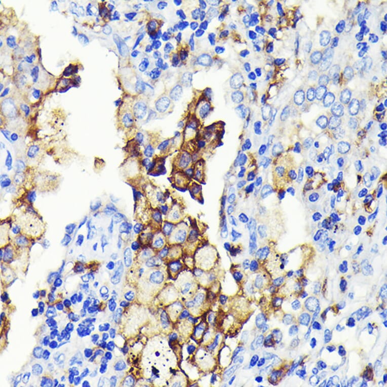 Immunohistochemistry - Anti-CD14 Antibody [ARC0353] (A308358) - Antibodies.com