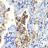 Immunohistochemistry - Anti-CD14 Antibody [ARC0353] (A308358) - Antibodies.com