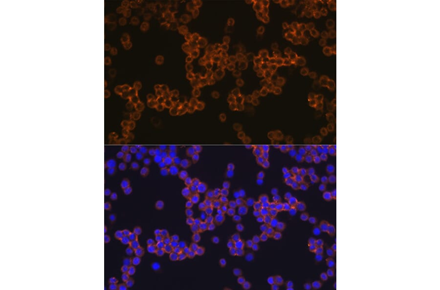 Immunofluorescence - Anti-CD14 Antibody [ARC0353] (A308358) - Antibodies.com