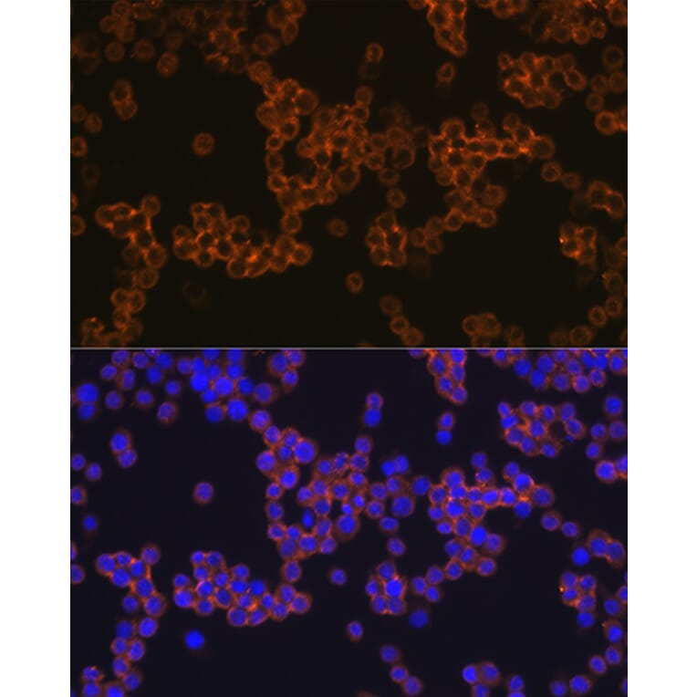 Immunofluorescence - Anti-CD14 Antibody [ARC0353] (A308358) - Antibodies.com