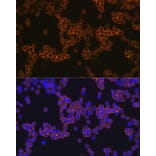 Immunofluorescence - Anti-CD14 Antibody [ARC0353] (A308358) - Antibodies.com