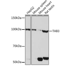 Western Blot - Anti-TAB3 Antibody (A308359) - Antibodies.com