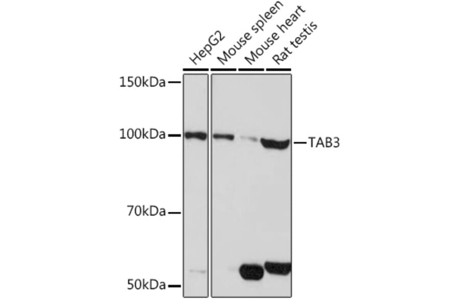 Western Blot - Anti-TAB3 Antibody (A308359) - Antibodies.com