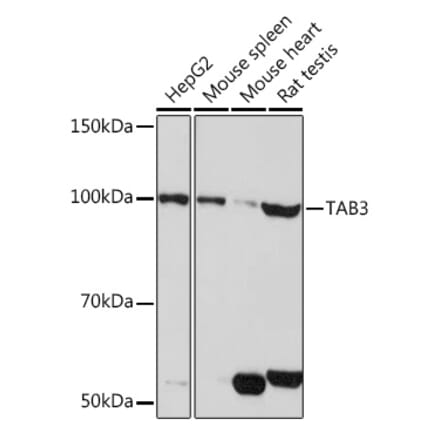 Western Blot - Anti-TAB3 Antibody (A308359) - Antibodies.com