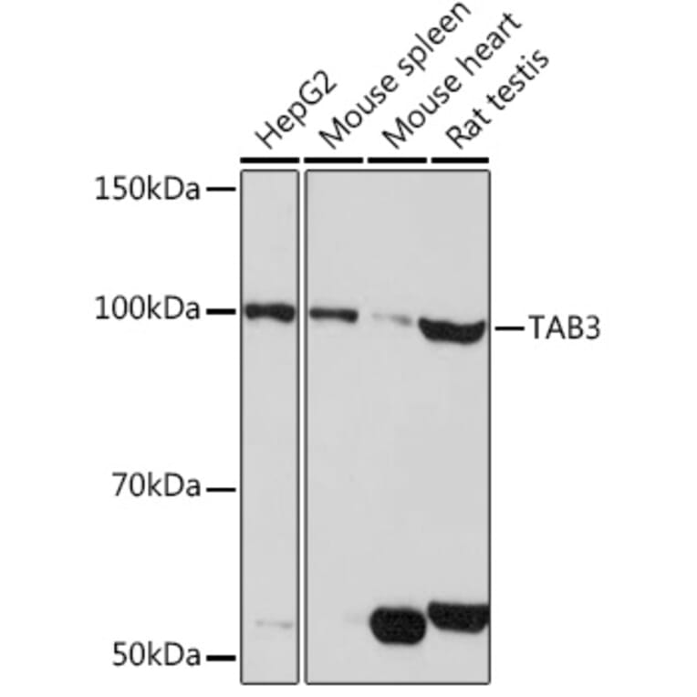 Western Blot - Anti-TAB3 Antibody (A308359) - Antibodies.com