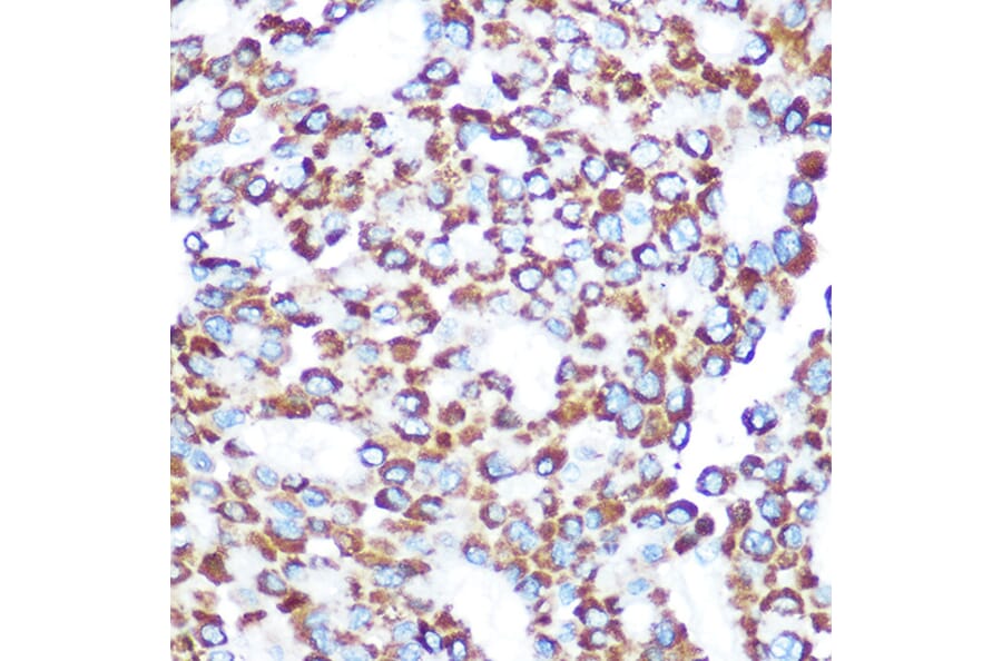 Immunohistochemistry - Anti-TAB3 Antibody (A308359) - Antibodies.com