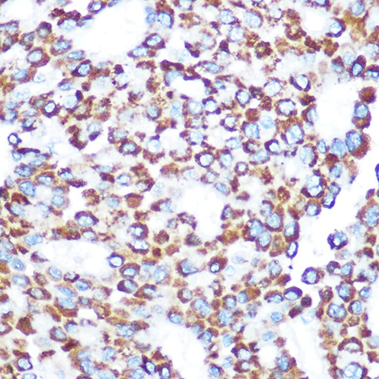 Immunohistochemistry - Anti-TAB3 Antibody (A308359) - Antibodies.com