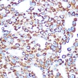 Immunohistochemistry - Anti-TAB3 Antibody (A308359) - Antibodies.com