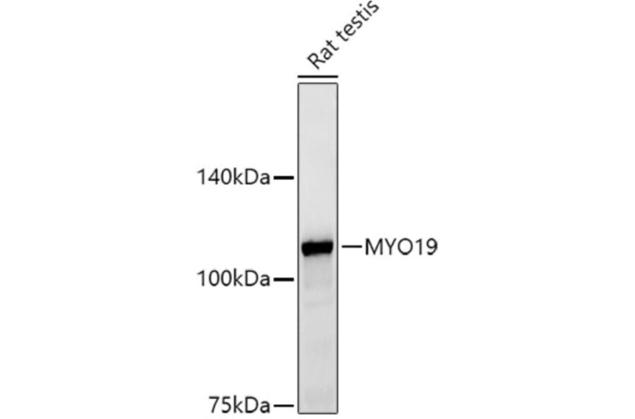 Western Blot - Anti-MYO19 Antibody [ARC2919] (A308360) - Antibodies.com