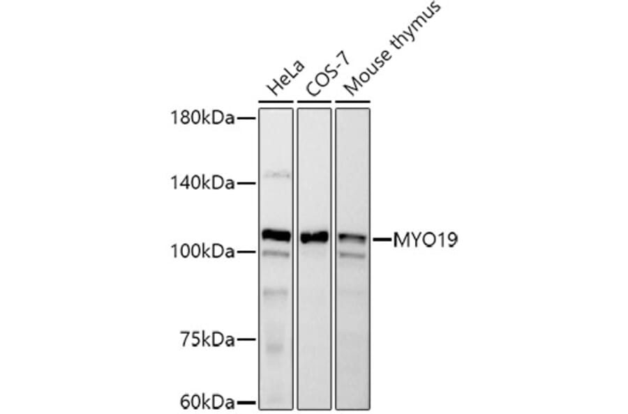 Western Blot - Anti-MYO19 Antibody [ARC2919] (A308360) - Antibodies.com
