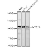 Western Blot - Anti-MYO19 Antibody [ARC2919] (A308360) - Antibodies.com
