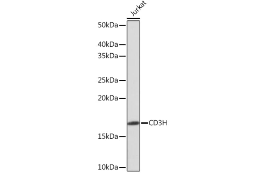 Western Blot - Anti-CD3 zeta Antibody [ARC0533] (A308361) - Antibodies.com
