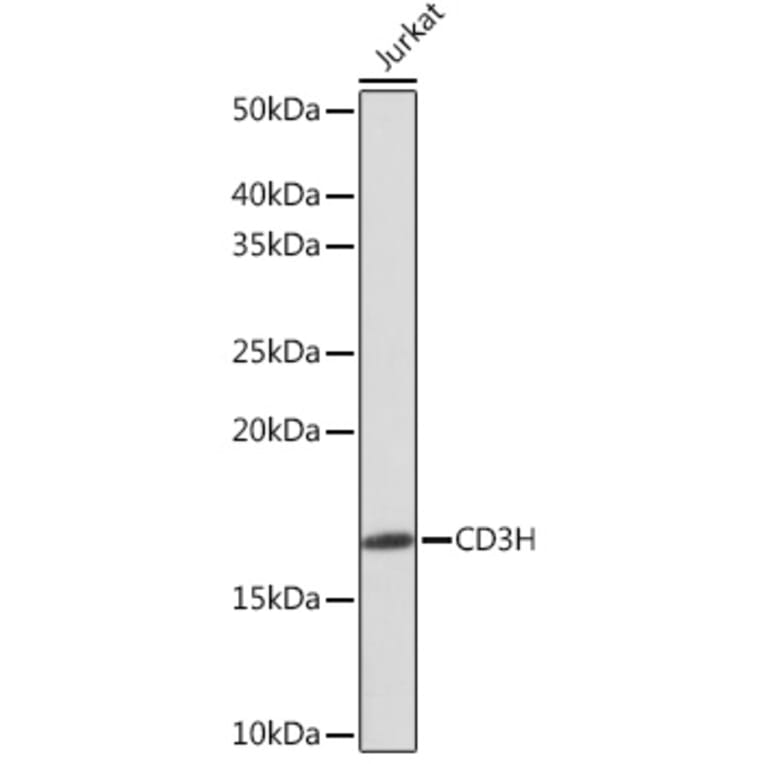 Western Blot - Anti-CD3 zeta Antibody [ARC0533] (A308361) - Antibodies.com
