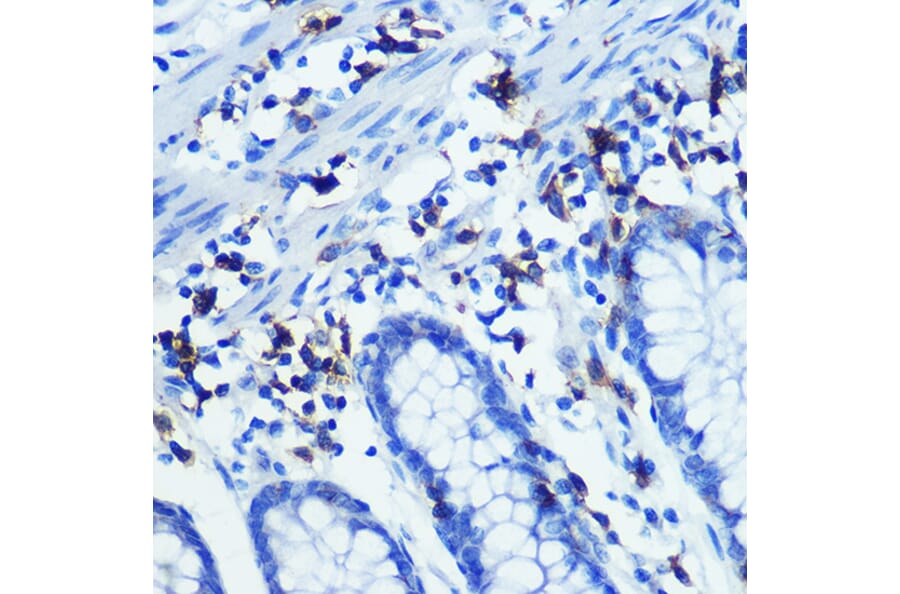 Immunohistochemistry - Anti-CD3 zeta Antibody [ARC0533] (A308361) - Antibodies.com
