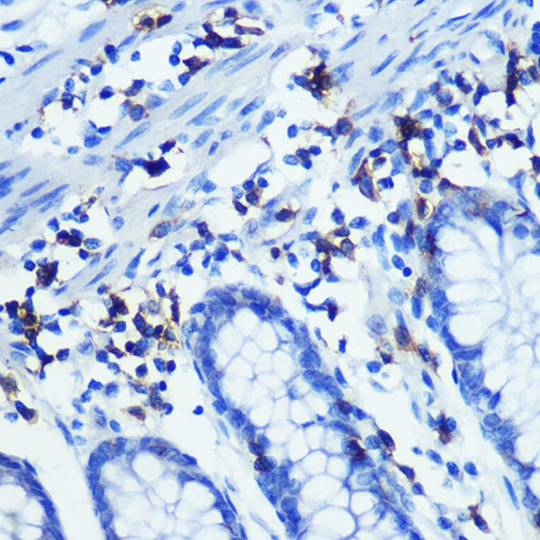 Immunohistochemistry - Anti-CD3 zeta Antibody [ARC0533] (A308361) - Antibodies.com