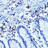 Immunohistochemistry - Anti-CD3 zeta Antibody [ARC0533] (A308361) - Antibodies.com