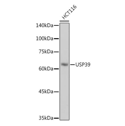 Western Blot - Anti-USP39 Antibody [ARC2565] (A308362) - Antibodies.com