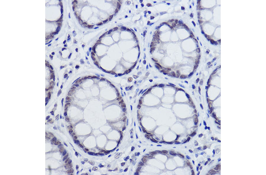Immunohistochemistry - Anti-USP39 Antibody [ARC2565] (A308362) - Antibodies.com