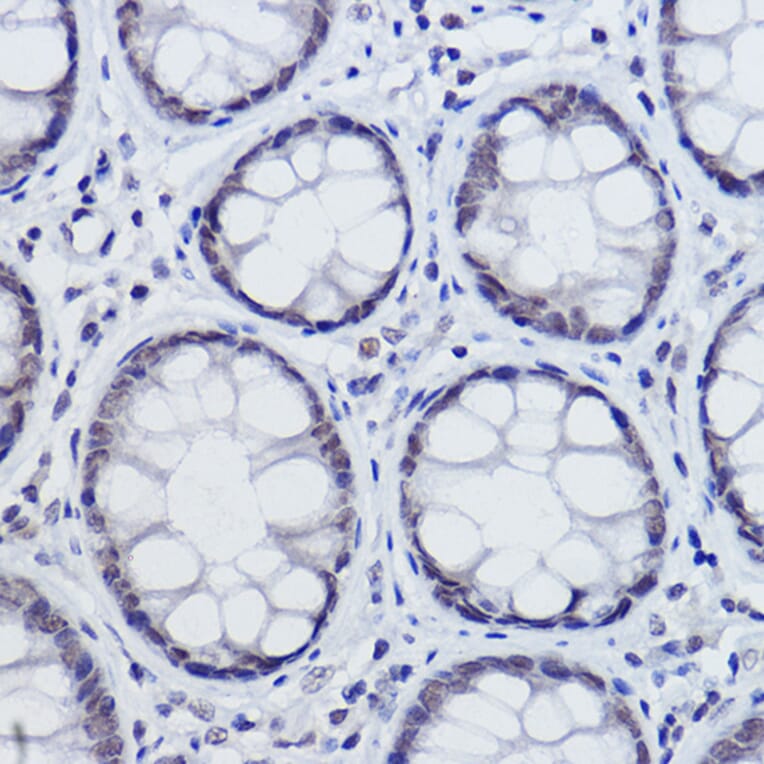 Immunohistochemistry - Anti-USP39 Antibody [ARC2565] (A308362) - Antibodies.com